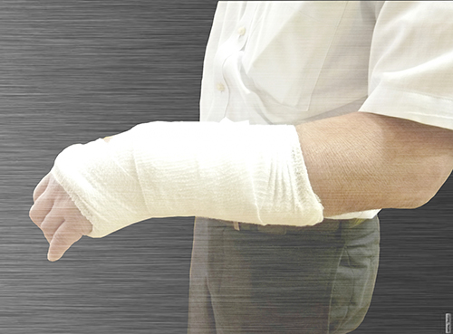 骨折・捻挫・脱臼・打撲